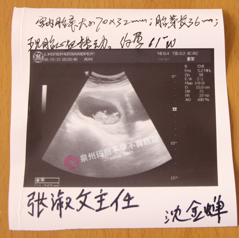 选择玛丽，百日快孕