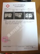 喜孕猴宝，盛迎2016!