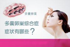 多囊性卵巢综合症