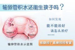 输卵管积水有什么症状?